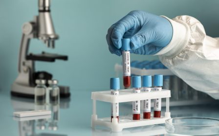 best-diagnostic-lab-in-South-Delhi-scaled